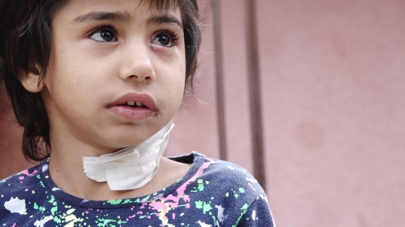 6 годишно дете бе нападнато от куче в село Долна Кремена