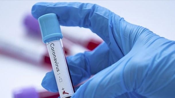 Трима са вече излекуваните от COVID 19 у нас Това каза за