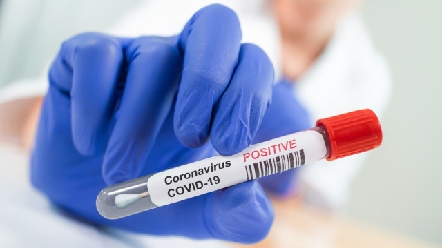 От Регионалната здравна инспекция съобщиха подробности за новозаразения с коронавирус