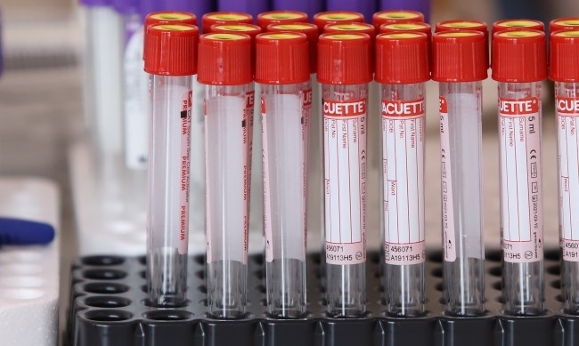 Новите потвърдени случаи на коронавирус у нас за последното денонощие