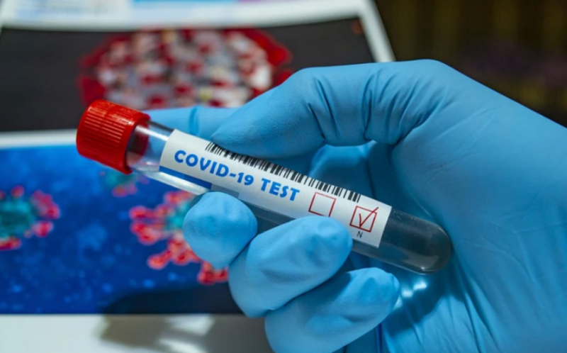 Новите потвърдени случаи на коронавирус у нас за последното денонощие са 199 като