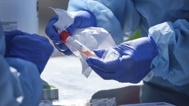 Четири са новите случаи на заразени с коронавирус в област