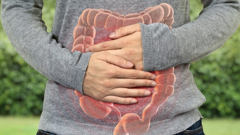 В България случаите на възпалителни чревни заболявания ВЧЗ нарастват значително Според Европейски