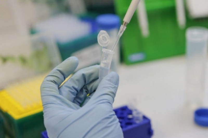 3414 са новодиагностицираните с коронавирусна инфекция лица през изминалите 24