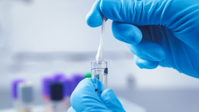 1 778 са потвърдените случаи на COVID 19 у нас по