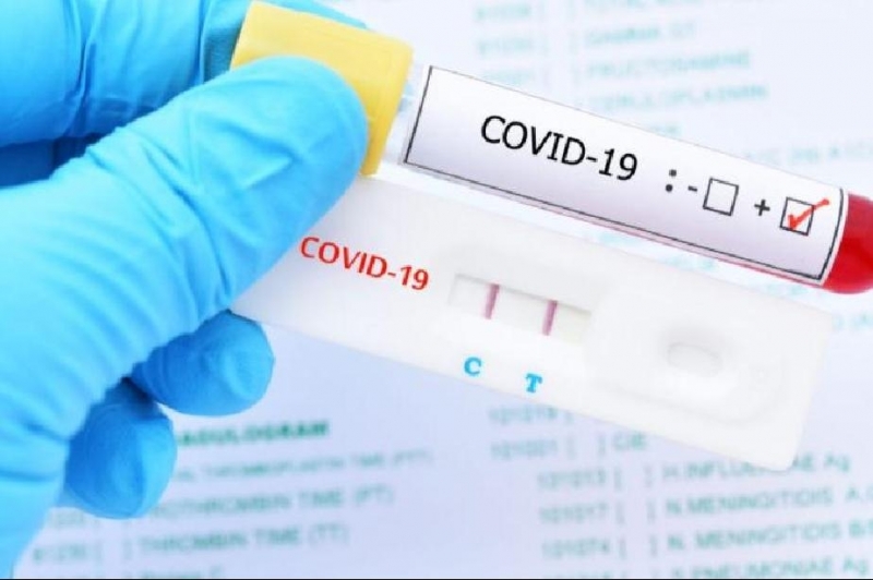 252 са новите случаи на COVID показват данните на Единния