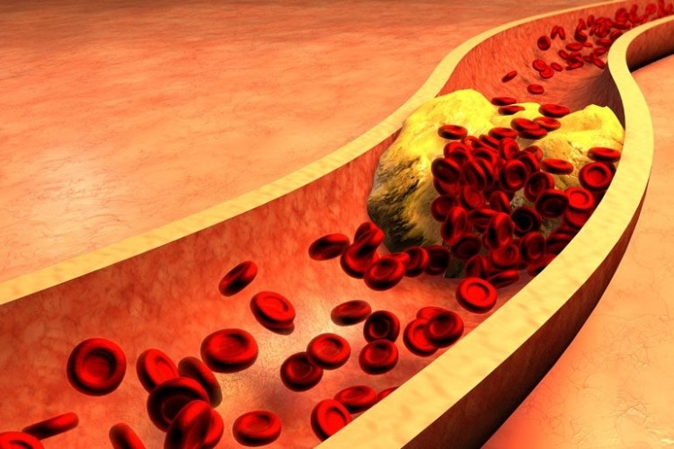 Нивото на холестерола в кръвта зависи от консумираната храна За