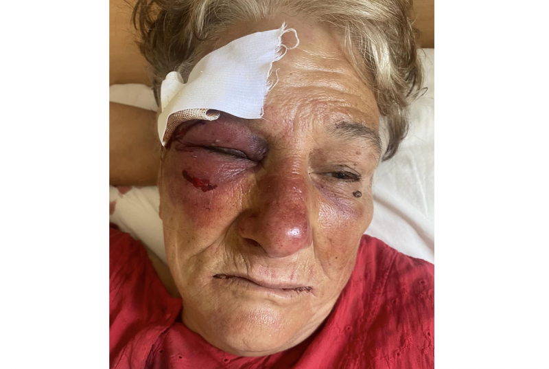 Възрастна жена от Оряхово е била пребита два пъти в