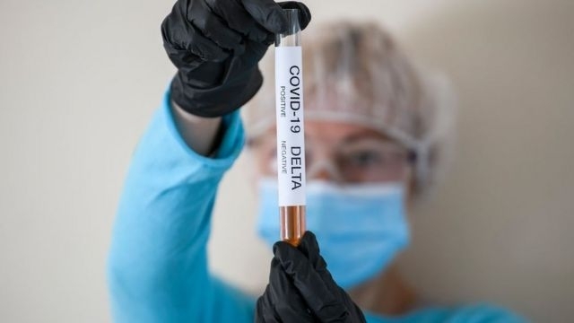 624 са новите диагностицирани с COVID 19 у нас за последните