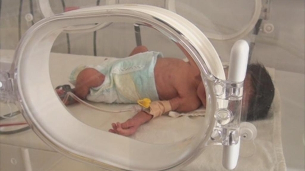 Стабилизирано е бебето на 38-годишната Маргарита от Враца, която почина