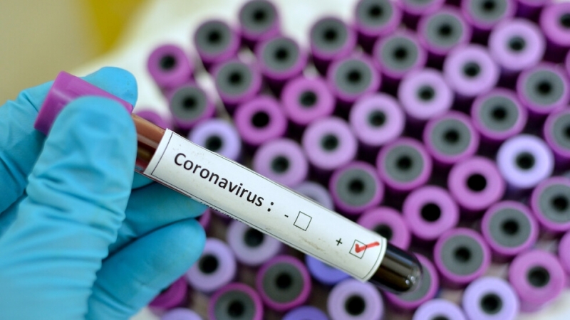 През последните 24 часа у нас за коронавирусна инфекция са
