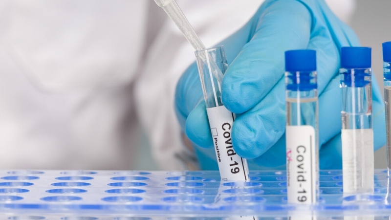 36 са новите случаи на коронавирус у нас Това показват