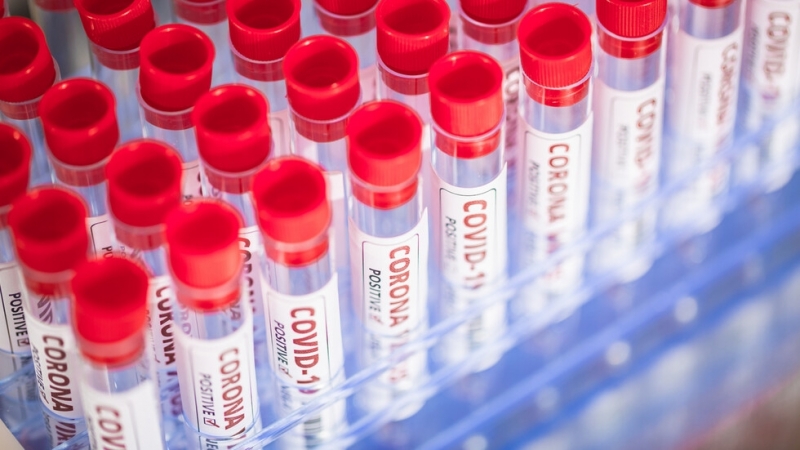 240 са новодиагностицираните с коронавирусна инфекция лица през изминалите 24