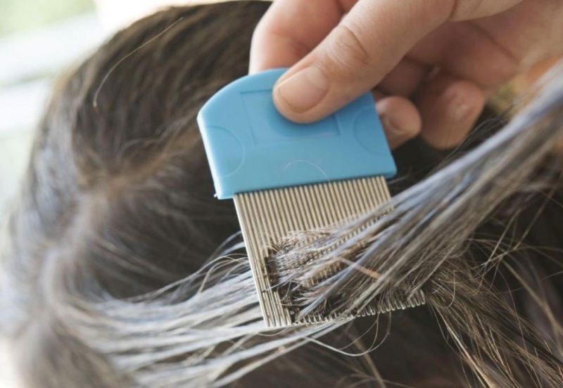 През последната година броят на опаразитените с главови въшки лица