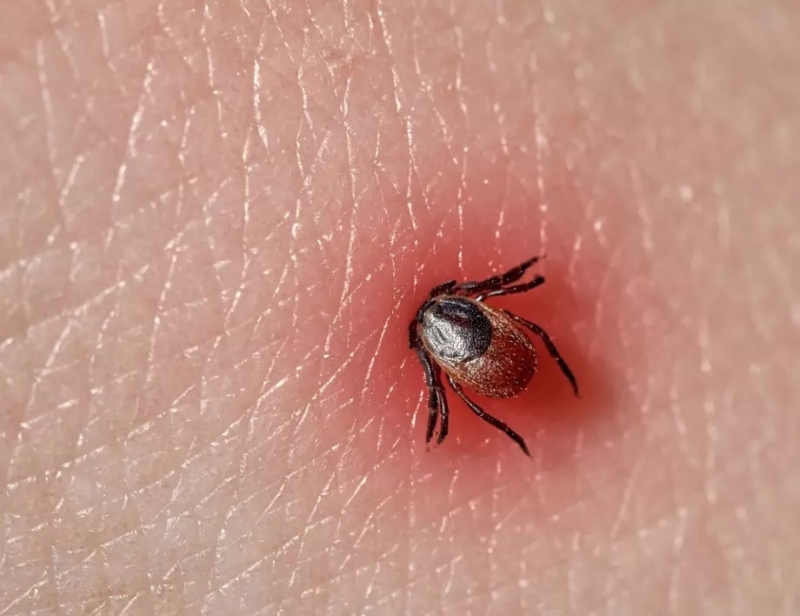 Случай на лаймска борелиоза е регистриран през изминалата седмица в