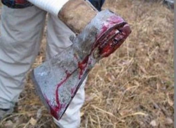 Възрастен мъж е бил ударен с брадва по главата във