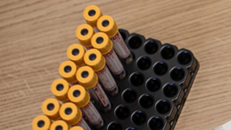 4 годишно дете от детска градина Пролет в Панагюрище е дало