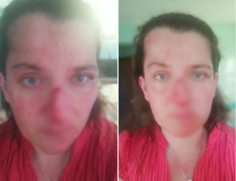 Мъж преби сестра си в собствения ѝ дом в Бургас