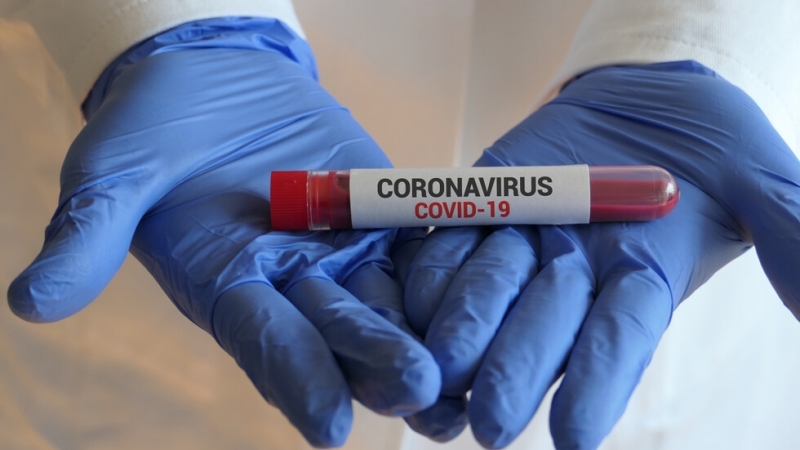 86 са новодиагностицираните с коронавирусна инфекция лица през изминалите 24