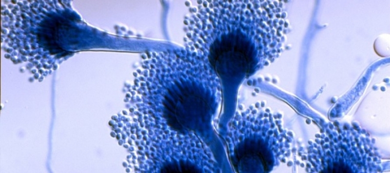 Чували ли сте за аспергилоза Става въпрос за малко познато