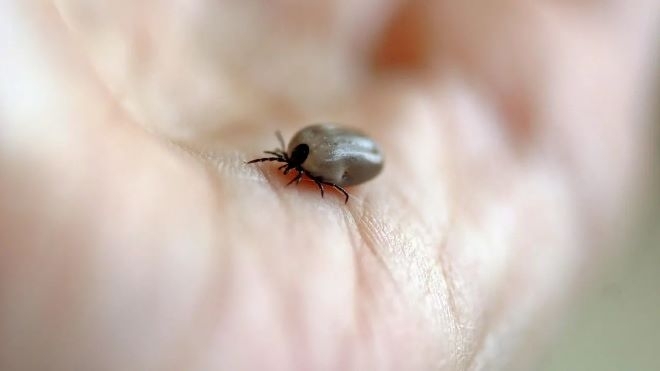 85 са случаите на лаймска болест в страната до момента