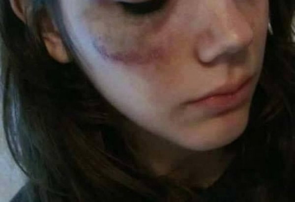 Мъж преби и ограби приятелката си в хотел в Лом