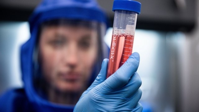 877 с 201 случая по малко от вчера са новодиагностицираните с