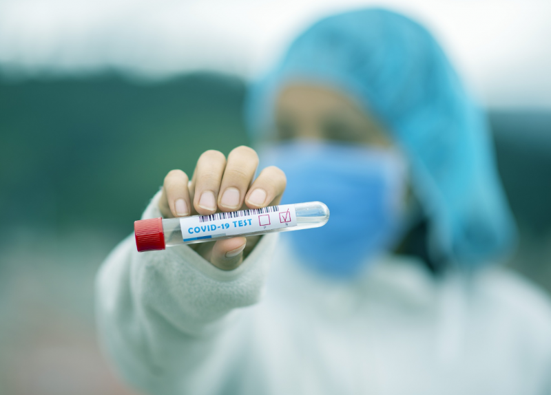 76 са новите регистрирани случаи с коронавирус в България за