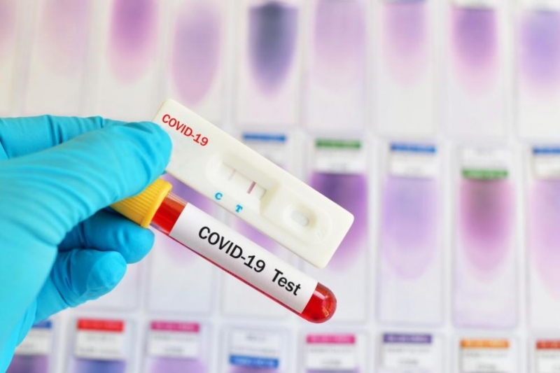 Девет са новите обявени случаи на коронавирус в областта съобщиха