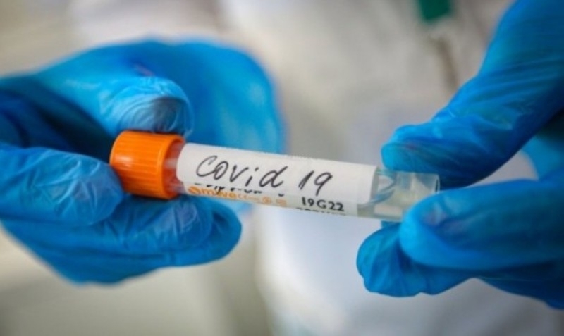 801 са новите потвърдени случаи на COVID 19 у нас за последното