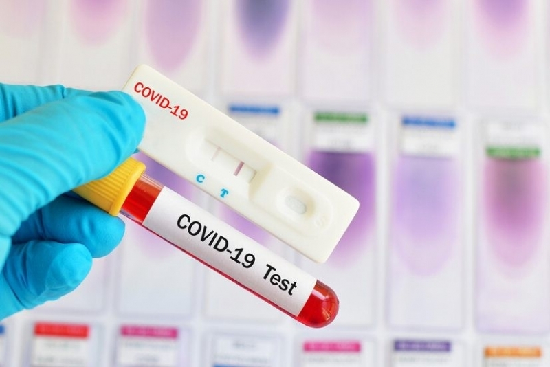 Сто нови случая на коронавирус са били регистрирани през последното денонощие