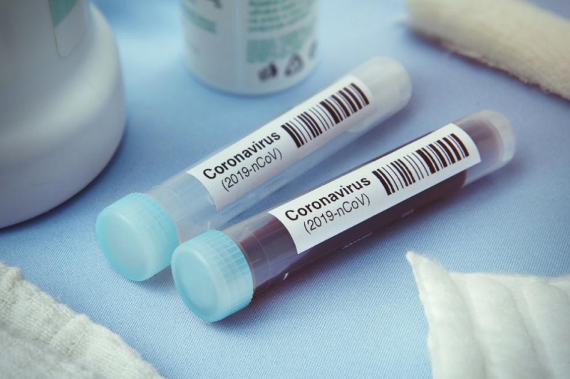 4 нови случая на инфектирани с коронавирус в област Монтана