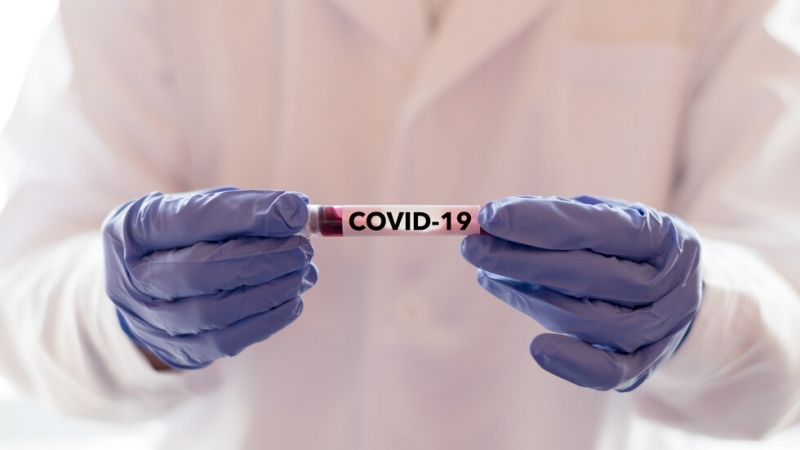 Испания регистрира в петък 17 смъртни случая от коронавируса което