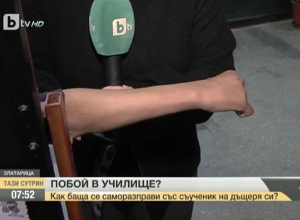 Момче в седми клас на училището в Златарица е с