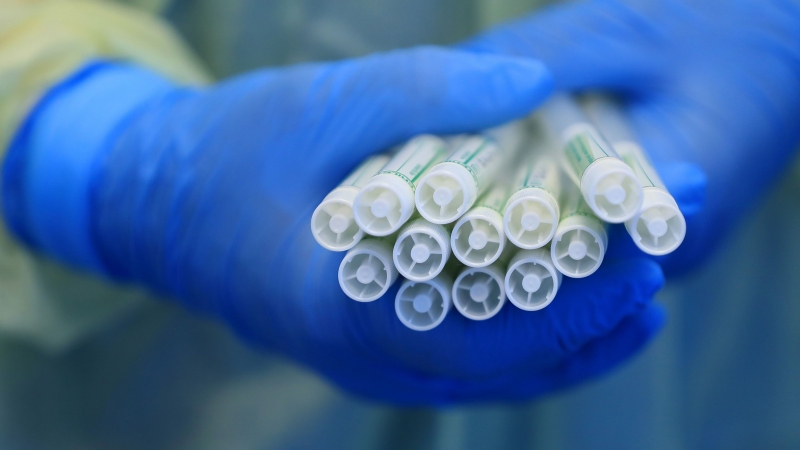 В цяла Гърция се отчита рязко увеличение на тежките случаи