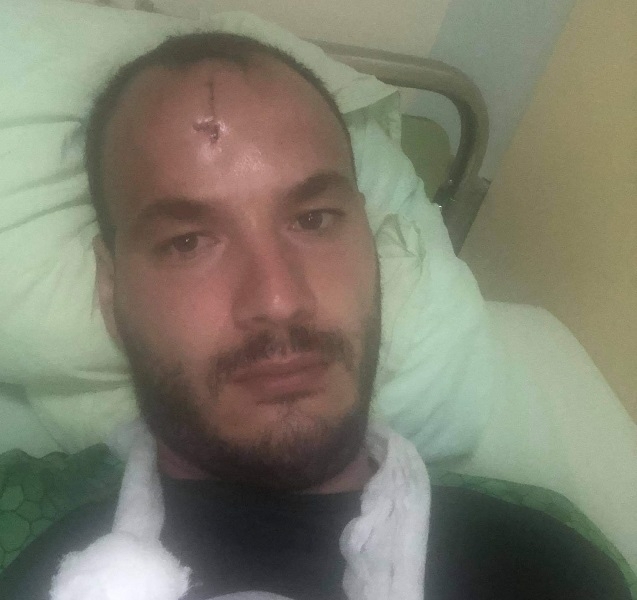 Вижте шокиращи подробности за боя в Роман, при който цигани нападнаха мъж с мачете /снимки/