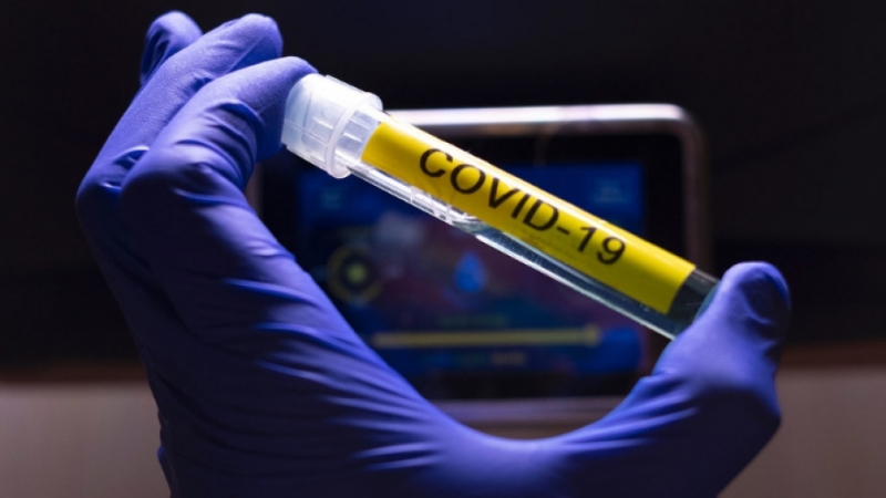 914 са новодиагностицираните с коронавирусна инфекция лица през изминалите 24