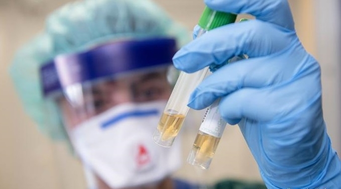 Заразените с COVID през последното денонощие са 1256 души Това