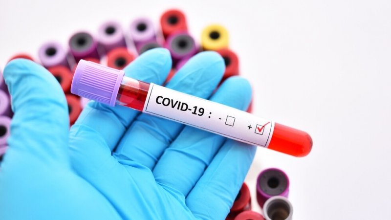 11 690 са потвърдените случаи на коронавирус в България, сочат