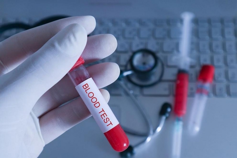 Кръвен тест за повече от 50 вида рак обещава пробив