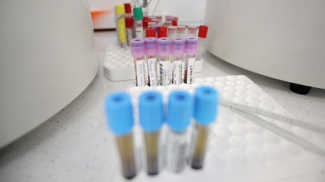 Има нов заразен във Видинско стана ясно на редовния сутрешен