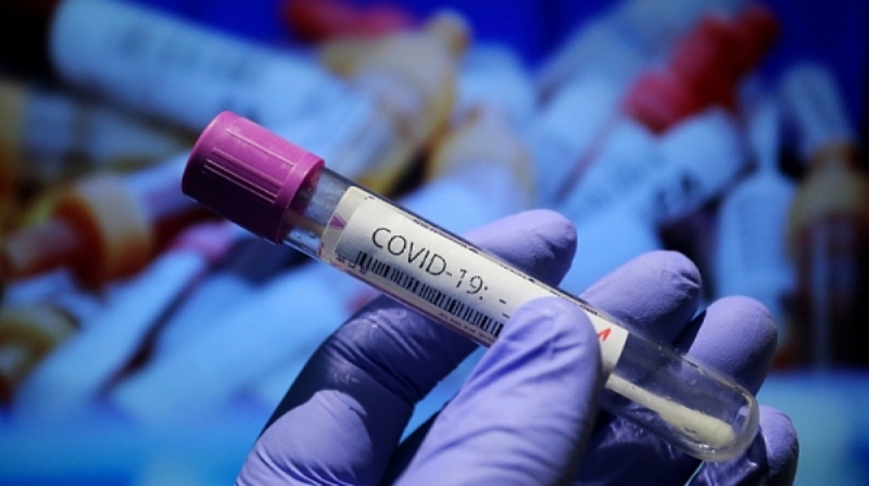 Новите потвърдени случаи на коронавирус у нас за последното денонощие са 563 при