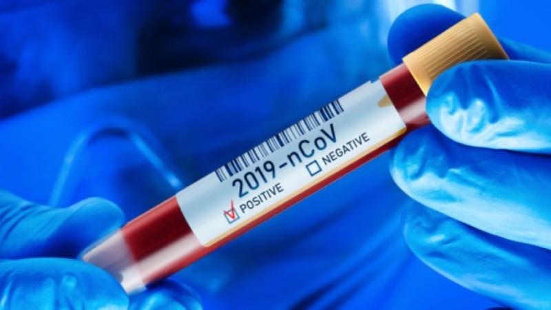 Новите потвърдени случаи на коронавирус у нас за последното денонощие