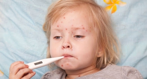 След като отмина грипната епидемия във Видинско нова зараза е