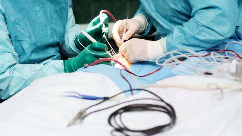 Монтански лекари извадиха 12 килограмов тумор от матката на жена научи