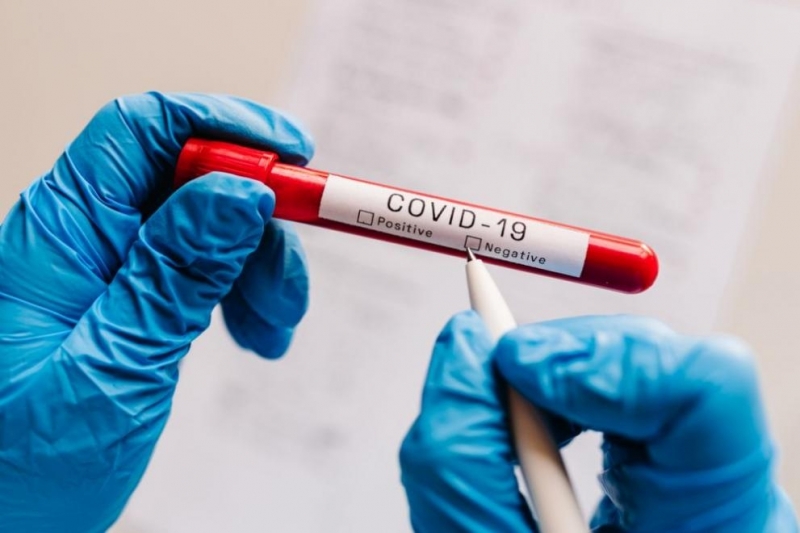 14 са новозаразените с коронавирус за последните 24 часа а