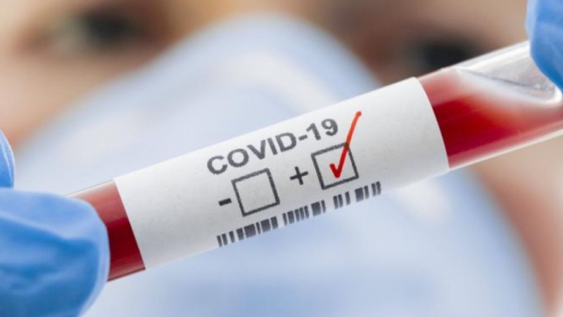 Шест са новите случаи на коронавирус в Монтана, сочат данните