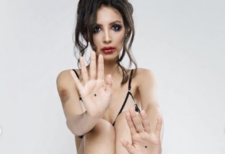 Депутатката и модел Динагюл Тасова публикува шокиращи снимки след свирепия
