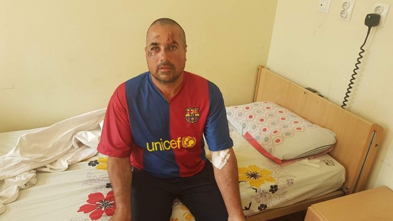 41 годишен мъж от врачанското село Габаре е бил брутално пребит