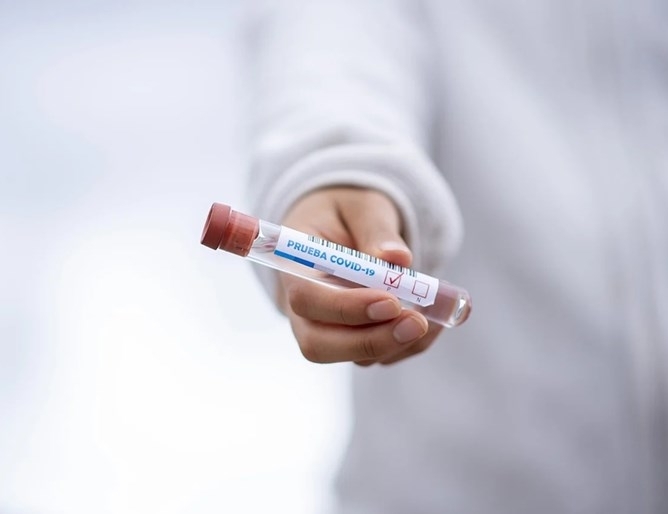 Словакия Полша и Австрия регистрираха рекорден ръст на случаите на коронавирус